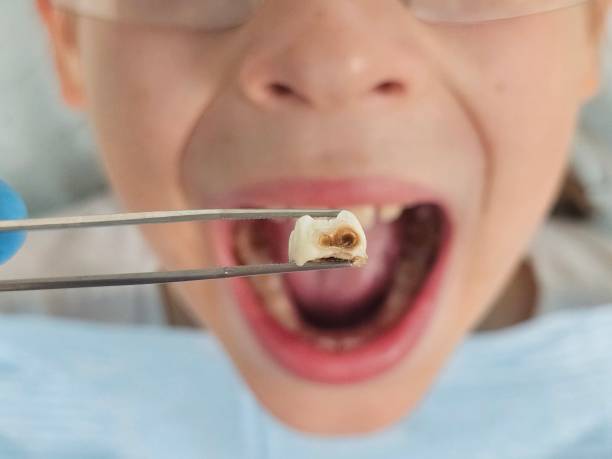 Best Pediatric Emergency Dentist in Kittery Point, ME