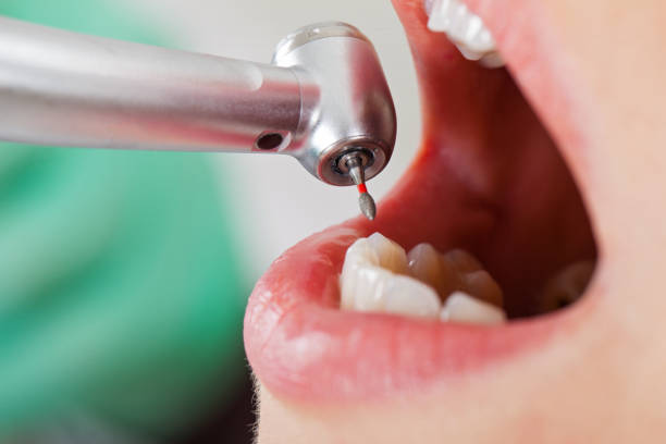 Best Emergency Broken Tooth Repair in Kittery Point, ME